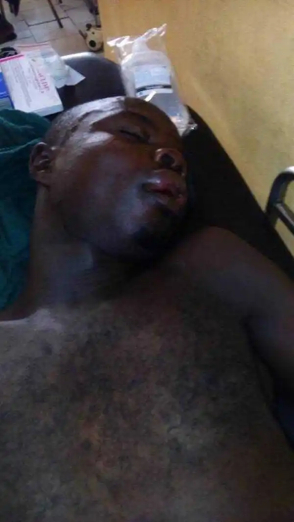 Unidentified Accident Victim Lying Unconscious At A Hospital In Abuja...[click to Read full]